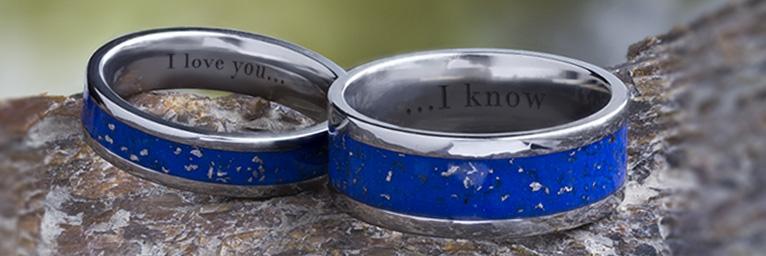 The Unique Hypoallergenic Wedding Band The Unique Hypoallergenic Wedding Band